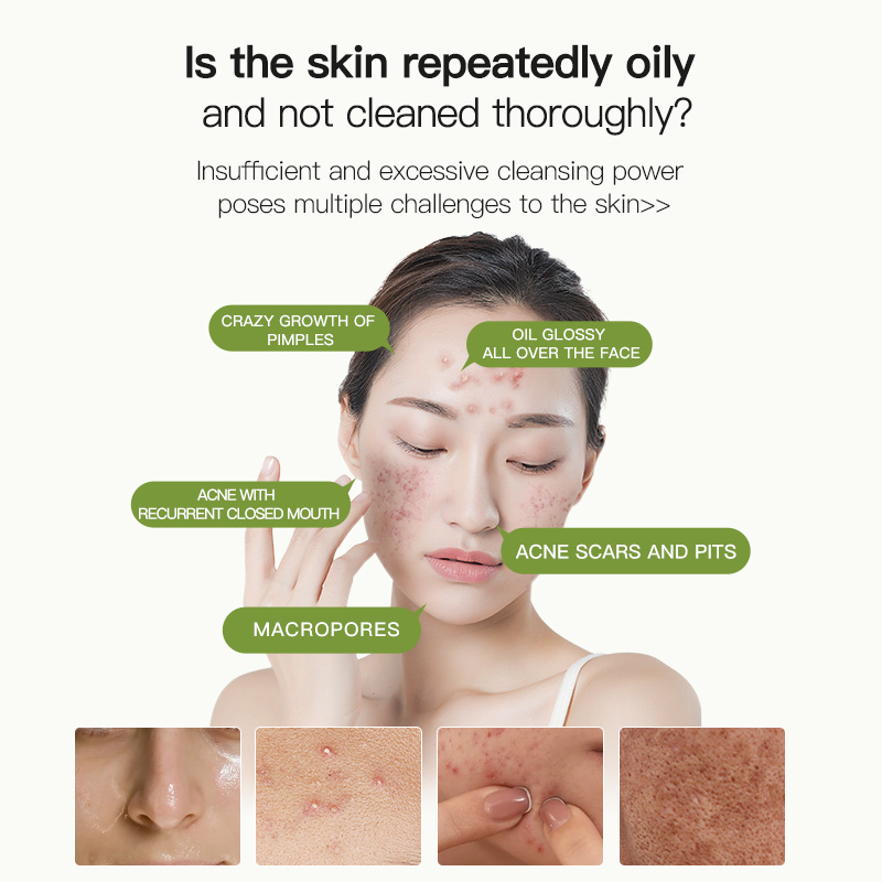 Australian Tea Tree Cleanser for Oily Skin, Facial Oil Control, Deep Cleansing for Men and Women(pic2)